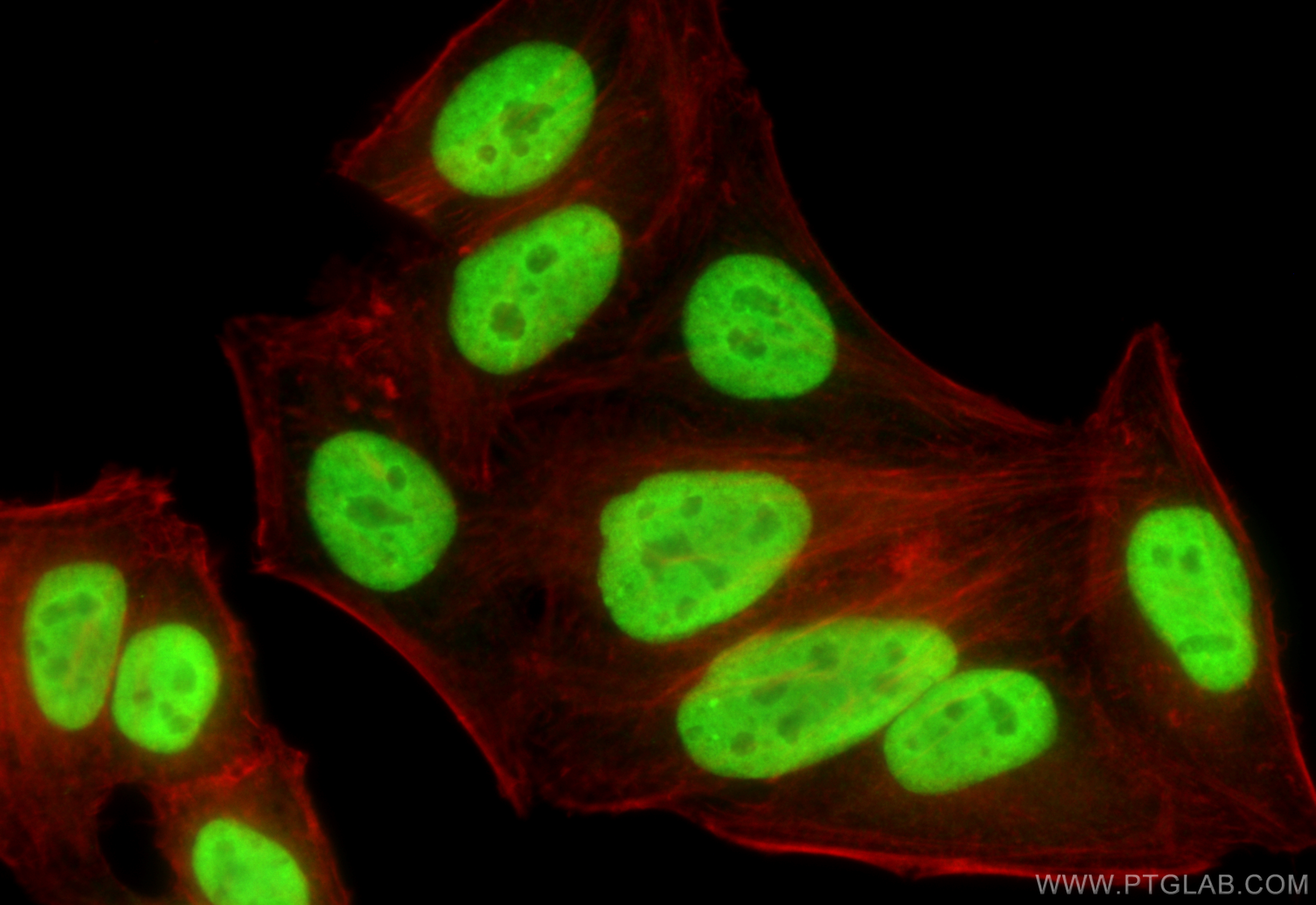 IF Staining of HepG2 using 11650-2-AP