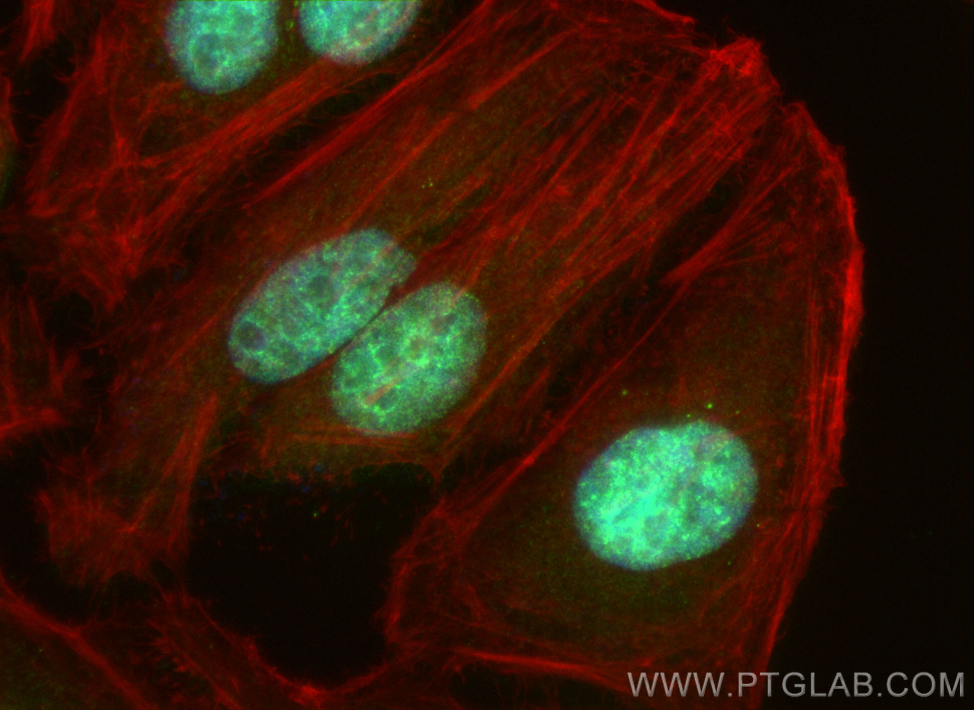 IF Staining of HeLa using 18544-1-AP