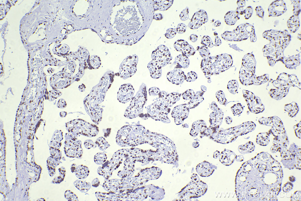 IHC staining of human placenta using 83258-5-RR (same clone as 83258-5-PBS)