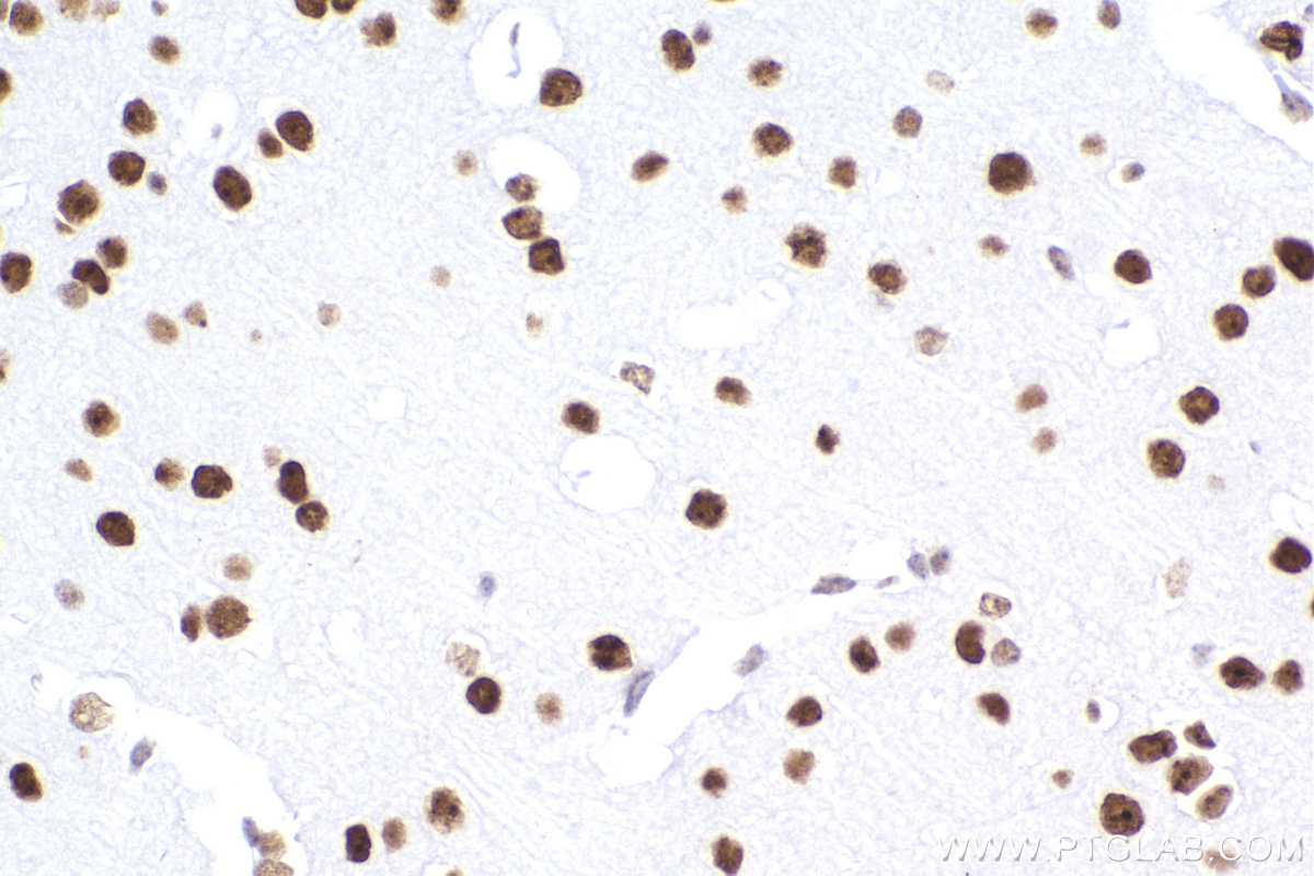 IHC staining of mouse brain using 83258-5-RR (same clone as 83258-5-PBS)