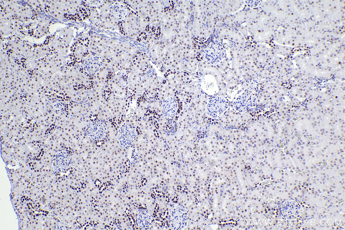 IHC staining of rat kidney using 83258-5-RR (same clone as 83258-5-PBS)