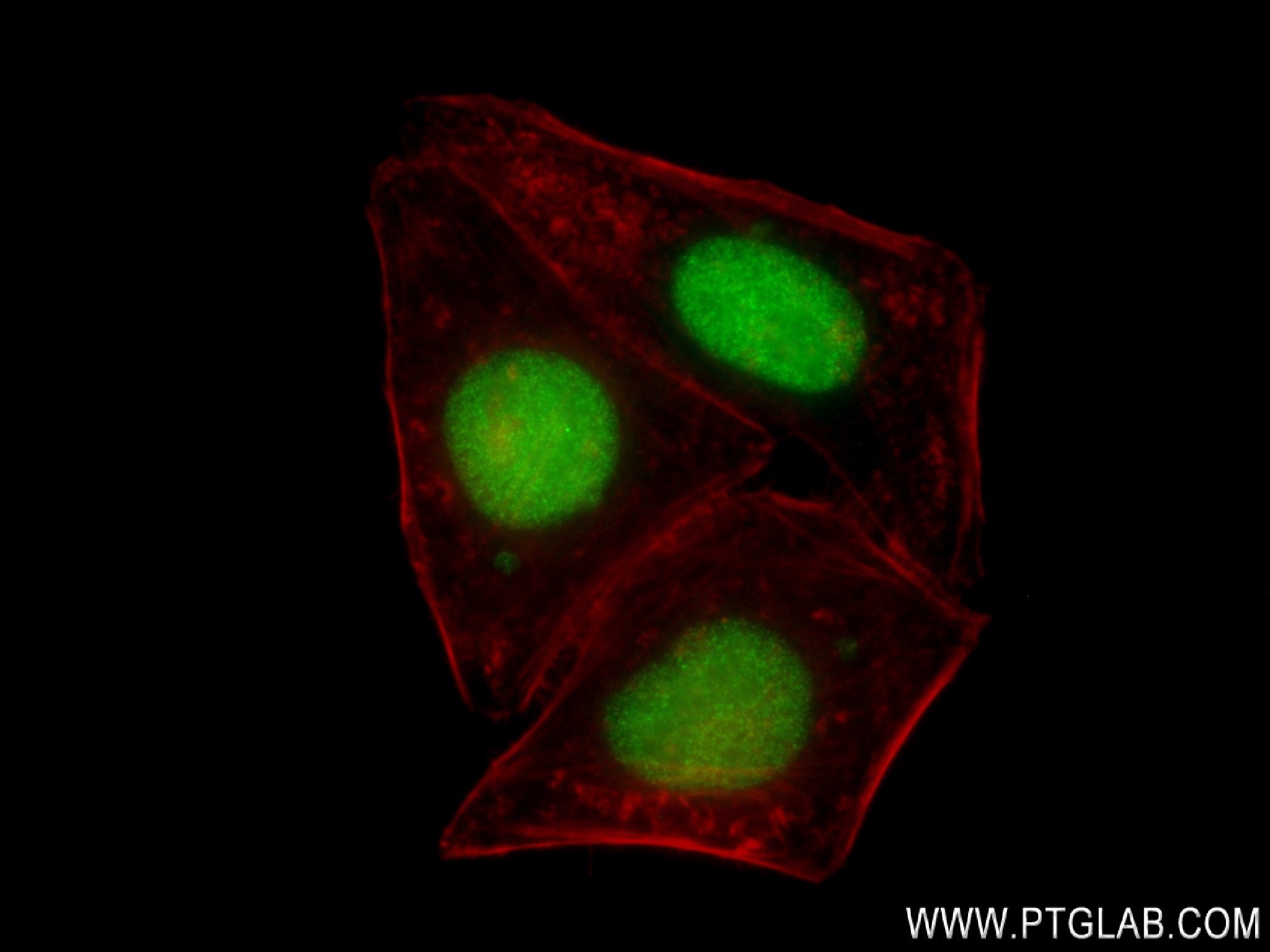 IF Staining of HepG2 using 83258-6-RR (same clone as 83258-6-PBS)