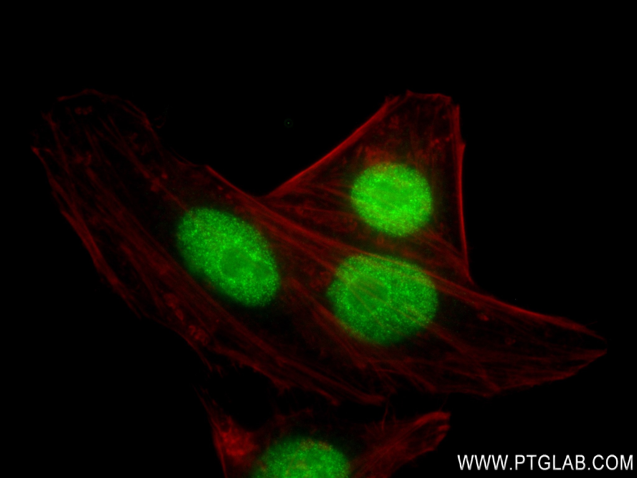 IF Staining of HepG2 using 83258-6-RR (same clone as 83258-6-PBS)