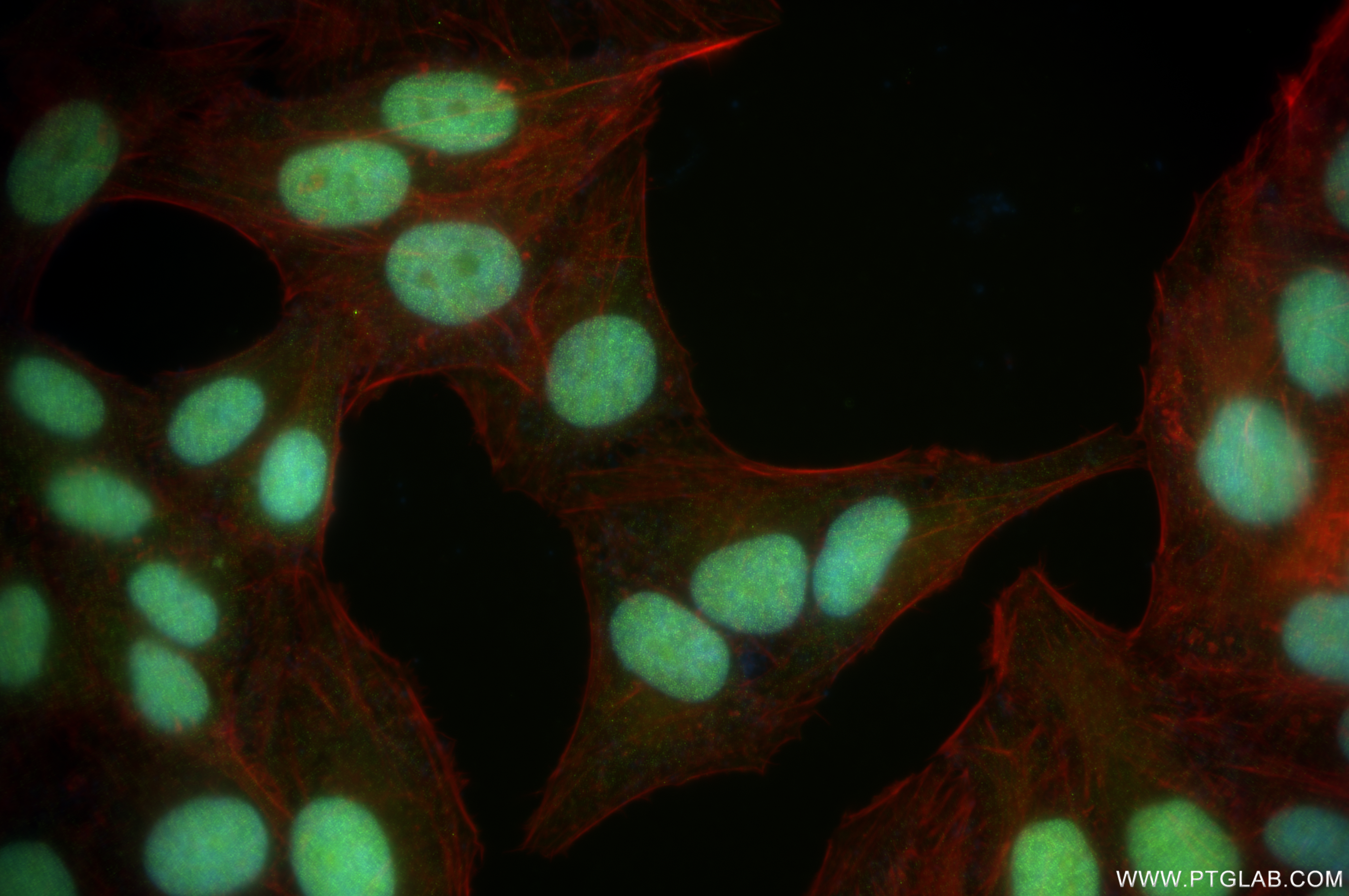 IF Staining of HepG2 using 83258-6-RR