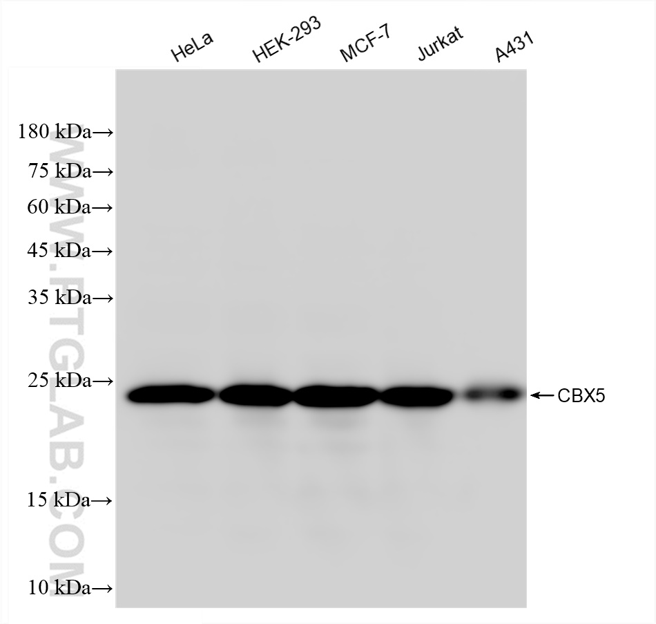 WB analysis using 83258-6-RR (same clone as 83258-6-PBS)