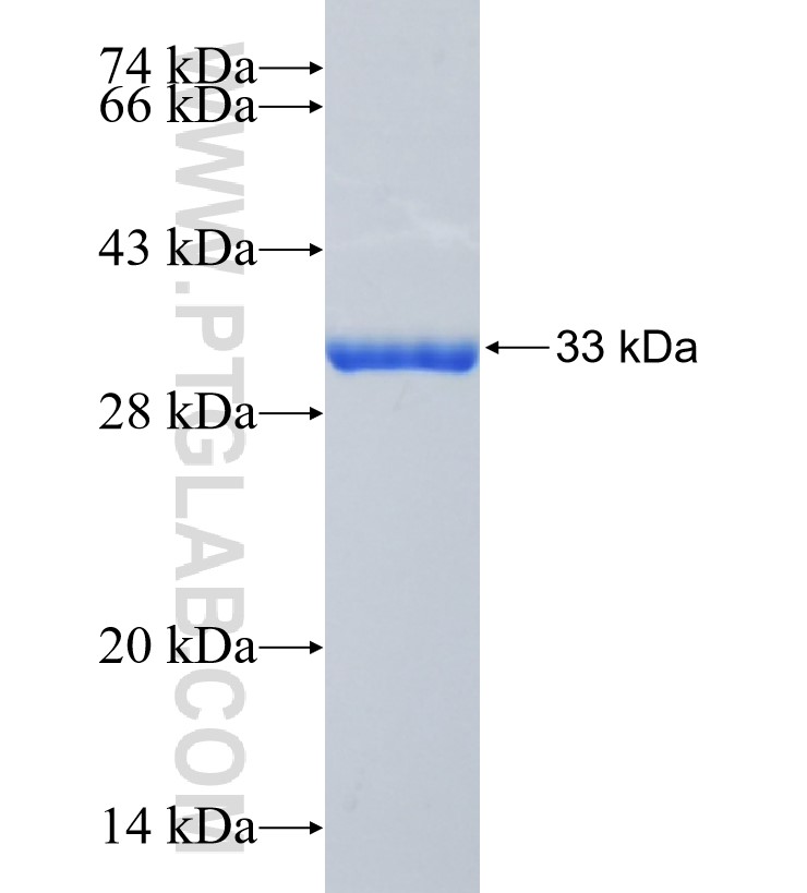 CBX5 fusion protein Ag34810 SDS-PAGE