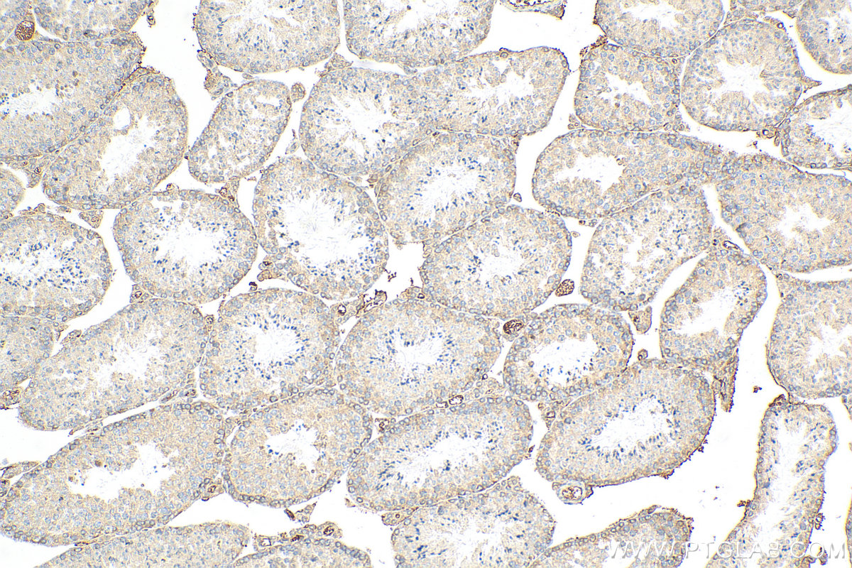 IHC staining of mouse testis using 68334-1-Ig (same clone as 68334-1-PBS)