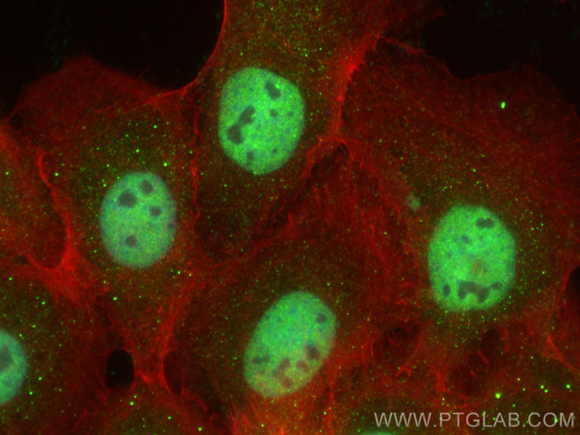 IF Staining of A431 using 25232-1-AP