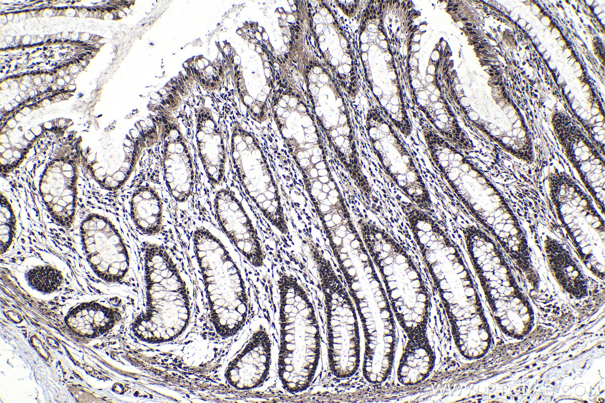 IHC staining of human colon using 25232-1-AP