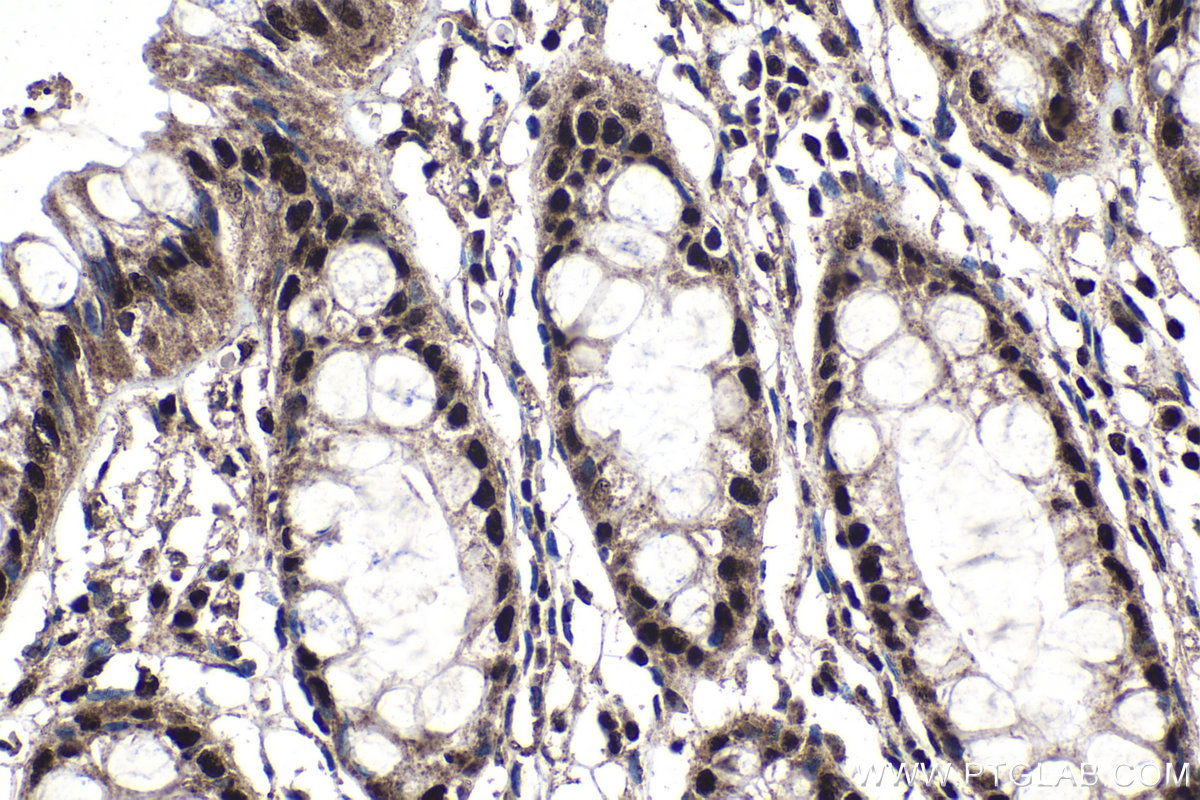 IHC staining of human colon using 25232-1-AP