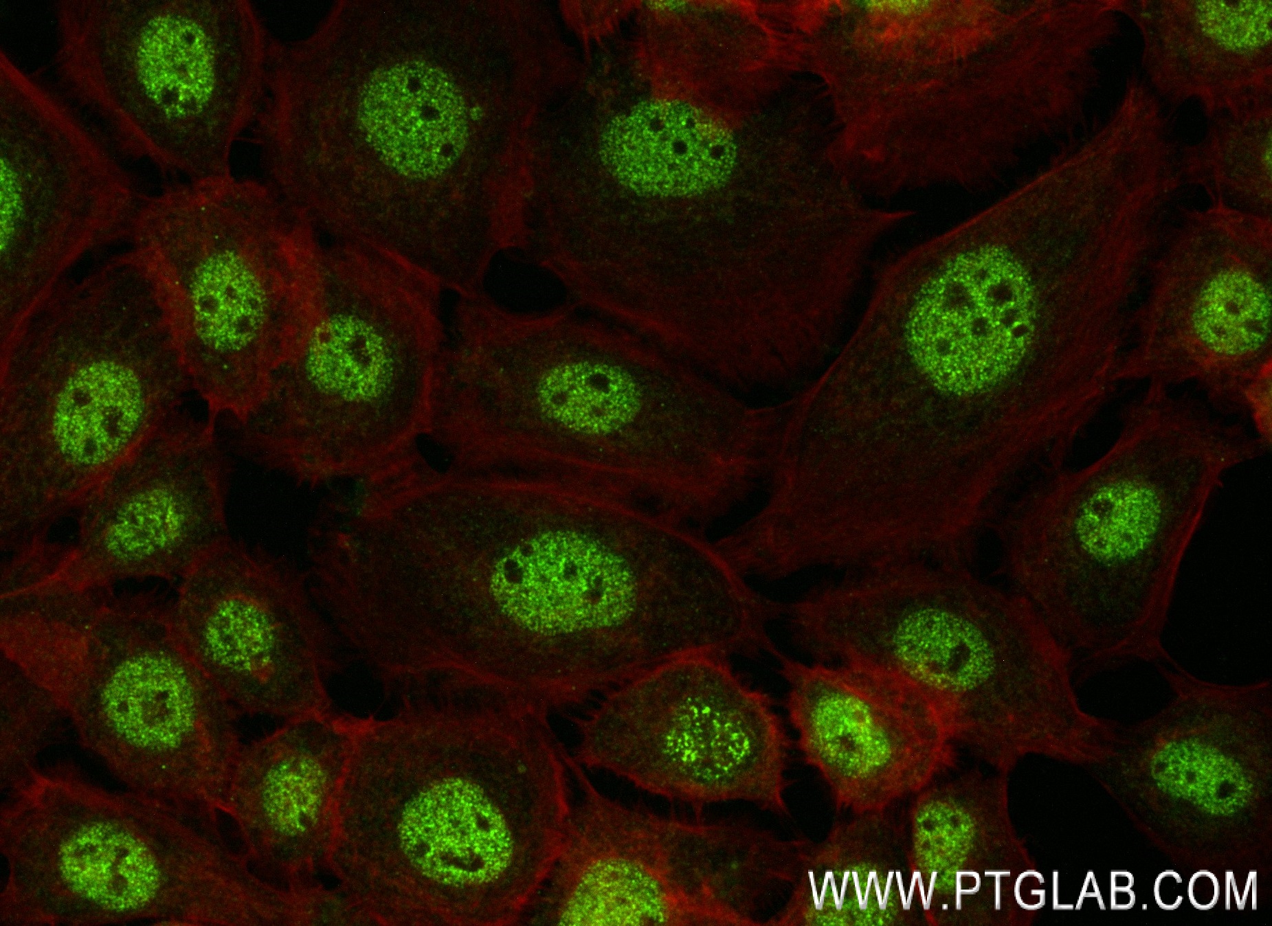 IF Staining of A431 using 83936-4-RR