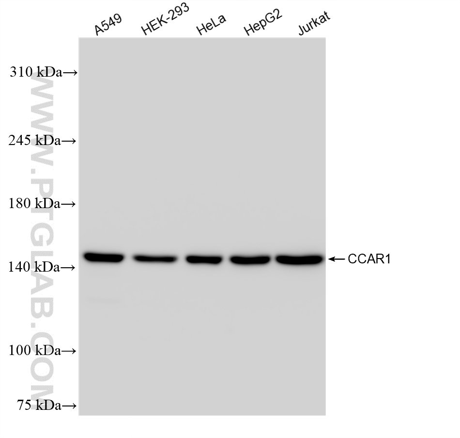 WB analysis using 83936-4-RR