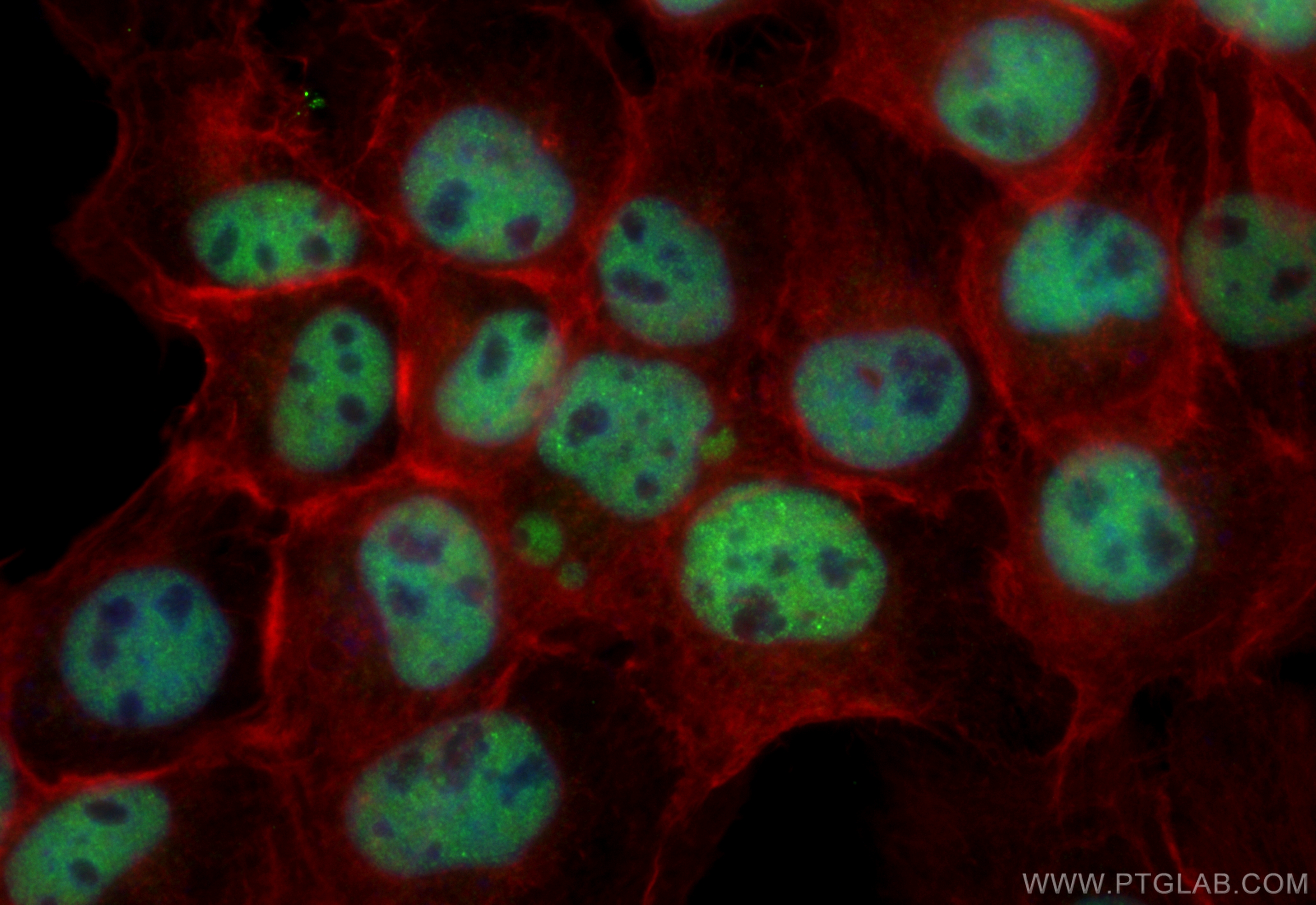 IF Staining of A431 using CL488-83936-4