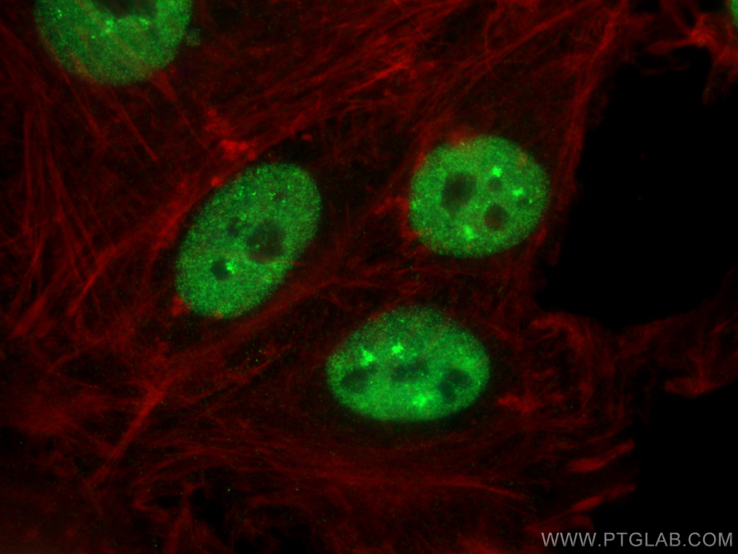 IF Staining of HeLa using 66497-1-Ig (same clone as 66497-1-PBS)