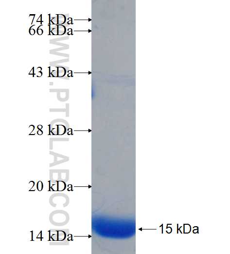 CCDC114 fusion protein Ag26081 SDS-PAGE