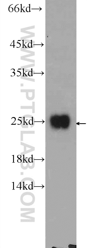 WB analysis of HeLa using 25138-1-AP