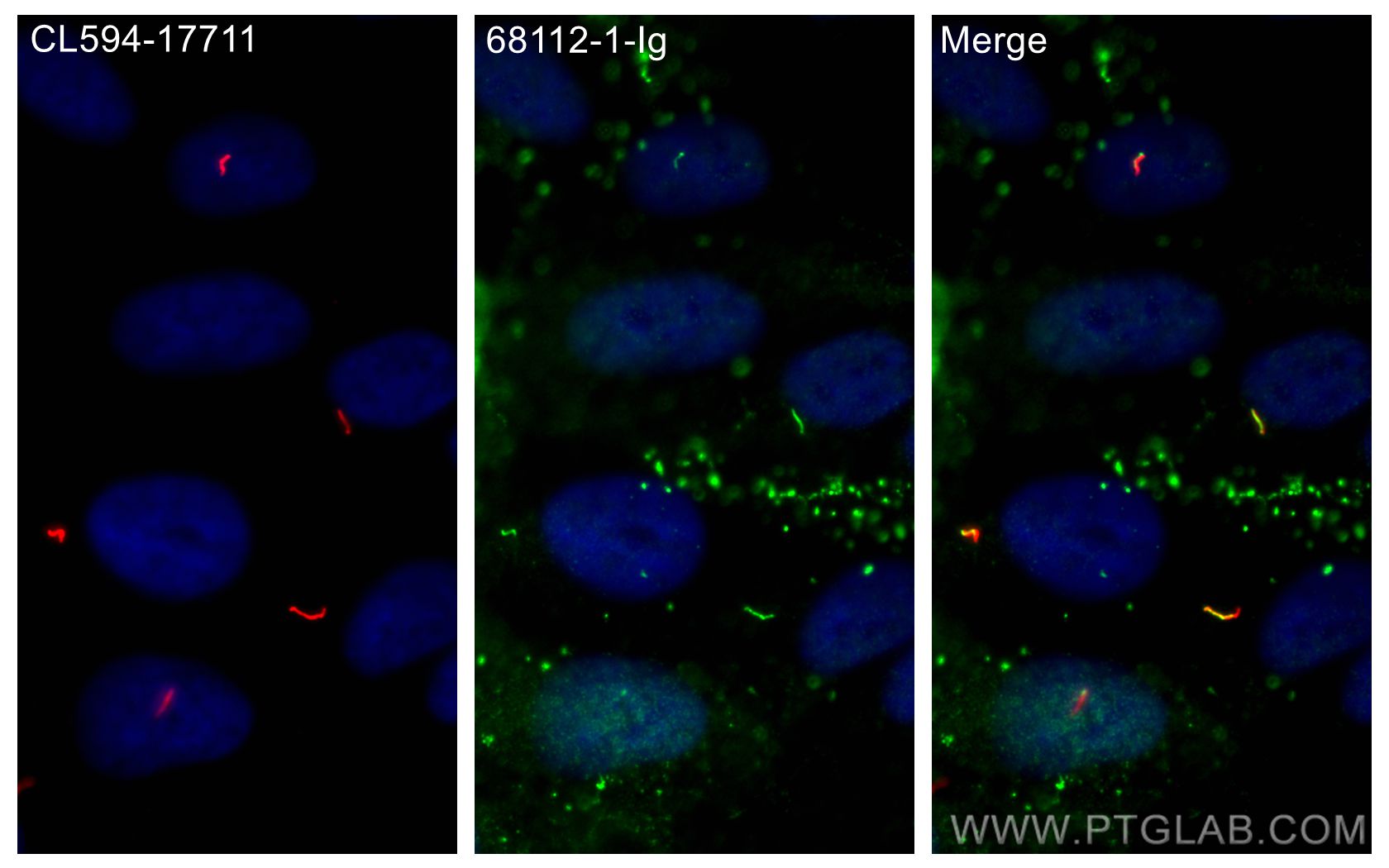 IF Staining of hTERT-RPE1 using 68112-1-Ig