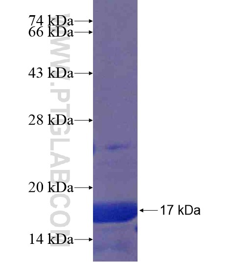 CCDC123 fusion protein Ag21214 SDS-PAGE