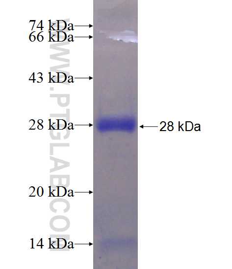 CCDC134 fusion protein Ag21996 SDS-PAGE