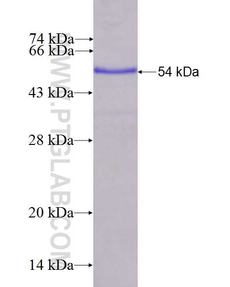 CCDC147 fusion protein Ag26943 SDS-PAGE