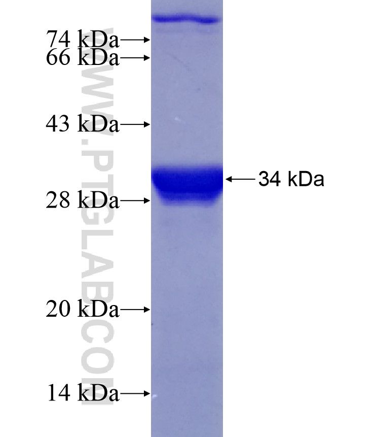 CCDC171 fusion protein Ag28964 SDS-PAGE