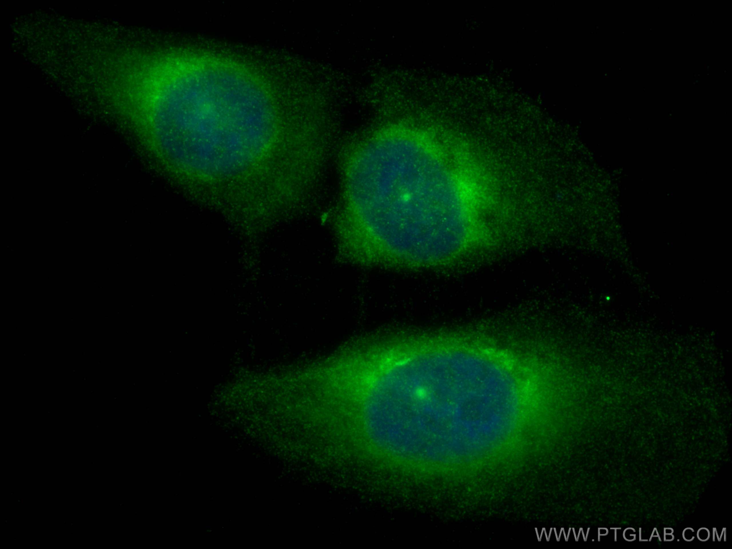 IF Staining of U2OS using 30024-1-AP