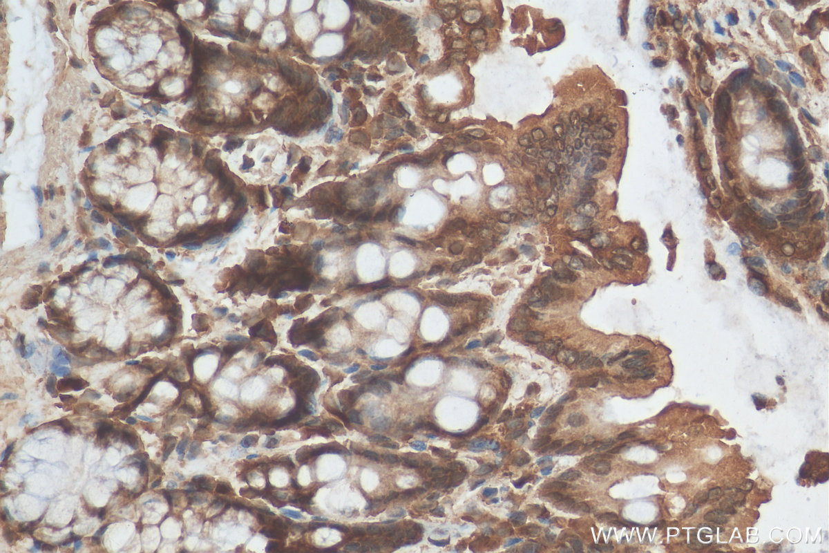 IHC staining of rat colon using 30024-1-AP