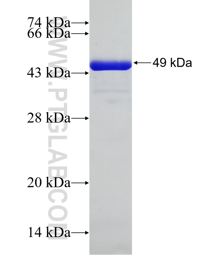 CCDC18 fusion protein Ag32681 SDS-PAGE