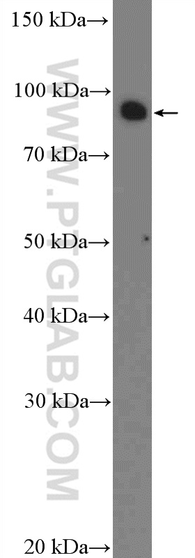 WB analysis of HeLa using 26314-1-AP