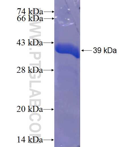 CCDC21 fusion protein Ag23587 SDS-PAGE