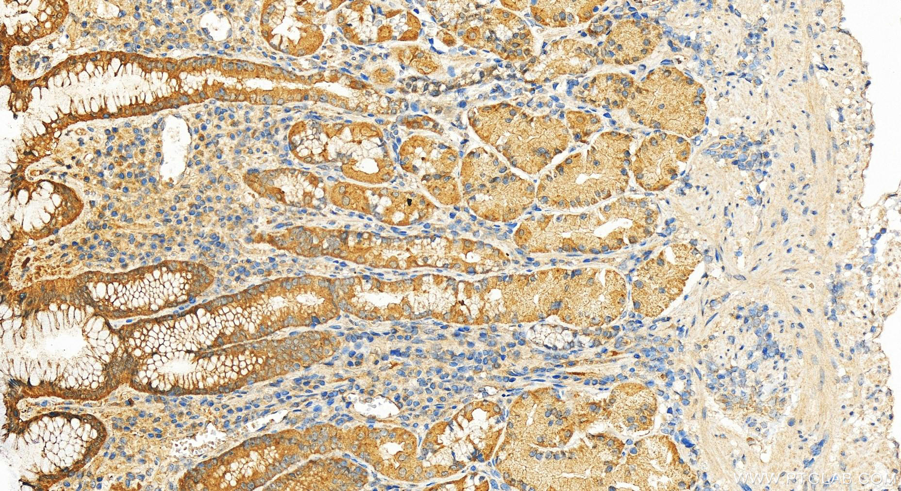 IHC staining of human stomach using 21209-1-AP