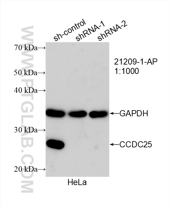 WB analysis of HeLa using 21209-1-AP