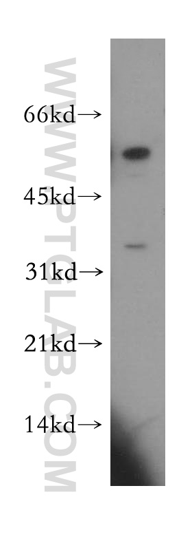 WB analysis of human skeletal muscle using 11530-1-AP