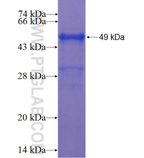 CCDC33 fusion protein Ag22893 SDS-PAGE