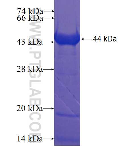 CCDC37 fusion protein Ag22686 SDS-PAGE