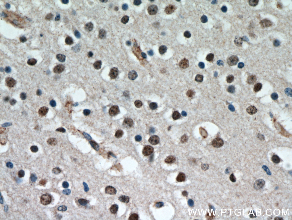 IHC staining of human brain using 20833-1-AP