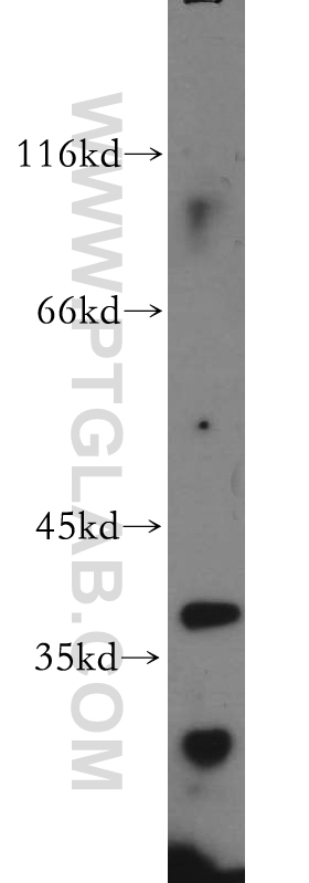 WB analysis of human testis using 20833-1-AP