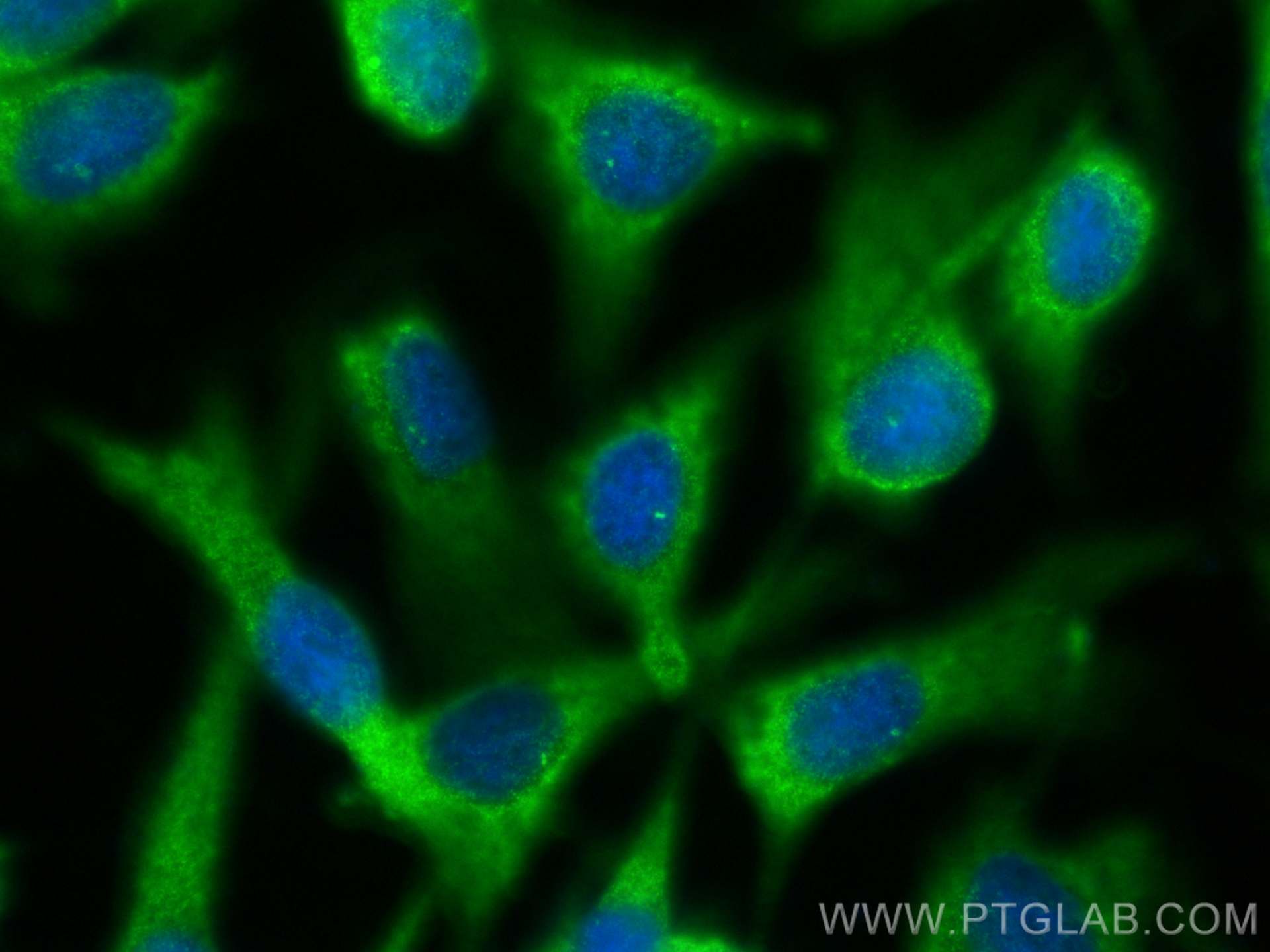 IF Staining of MDCK using 24928-1-AP