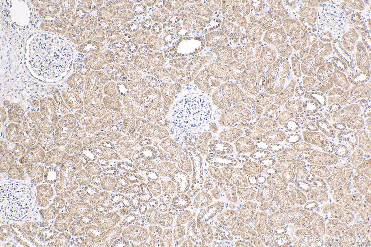 IHC staining of human kidney using 24416-1-AP