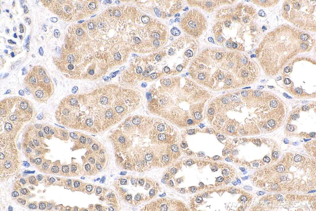 IHC staining of human kidney using 24416-1-AP