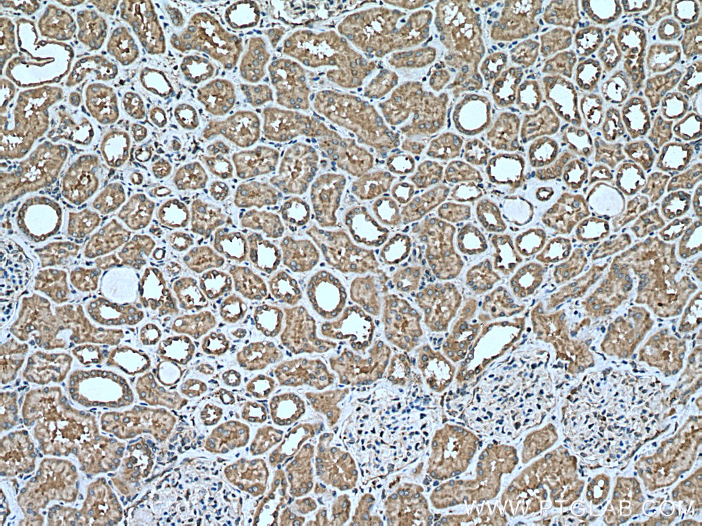 IHC staining of human kidney using 21082-1-AP