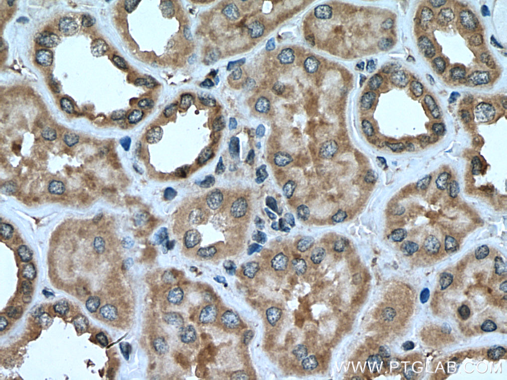 IHC staining of human kidney using 21082-1-AP