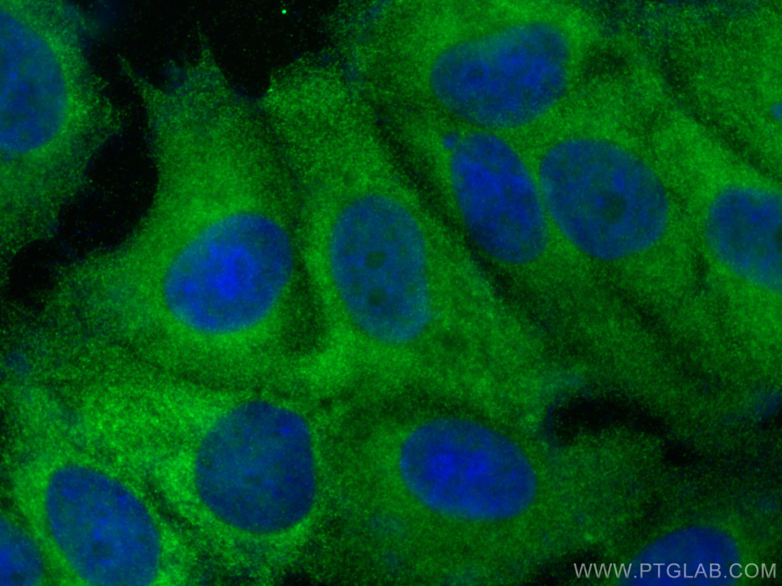 IF Staining of MCF-7 using 13717-1-AP