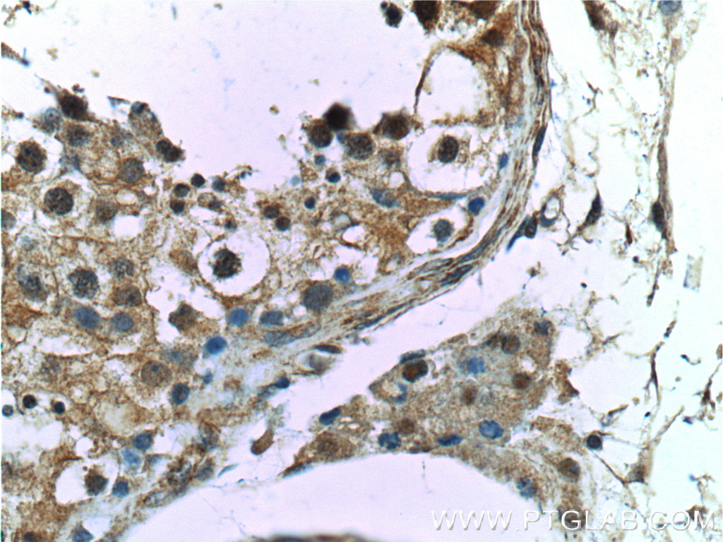 IHC staining of human testis using 25981-1-AP