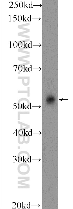 WB analysis of mouse testis using 25981-1-AP