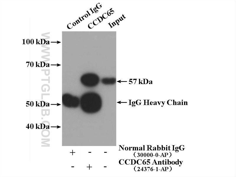 IP experiment of mouse testis using 24376-1-AP