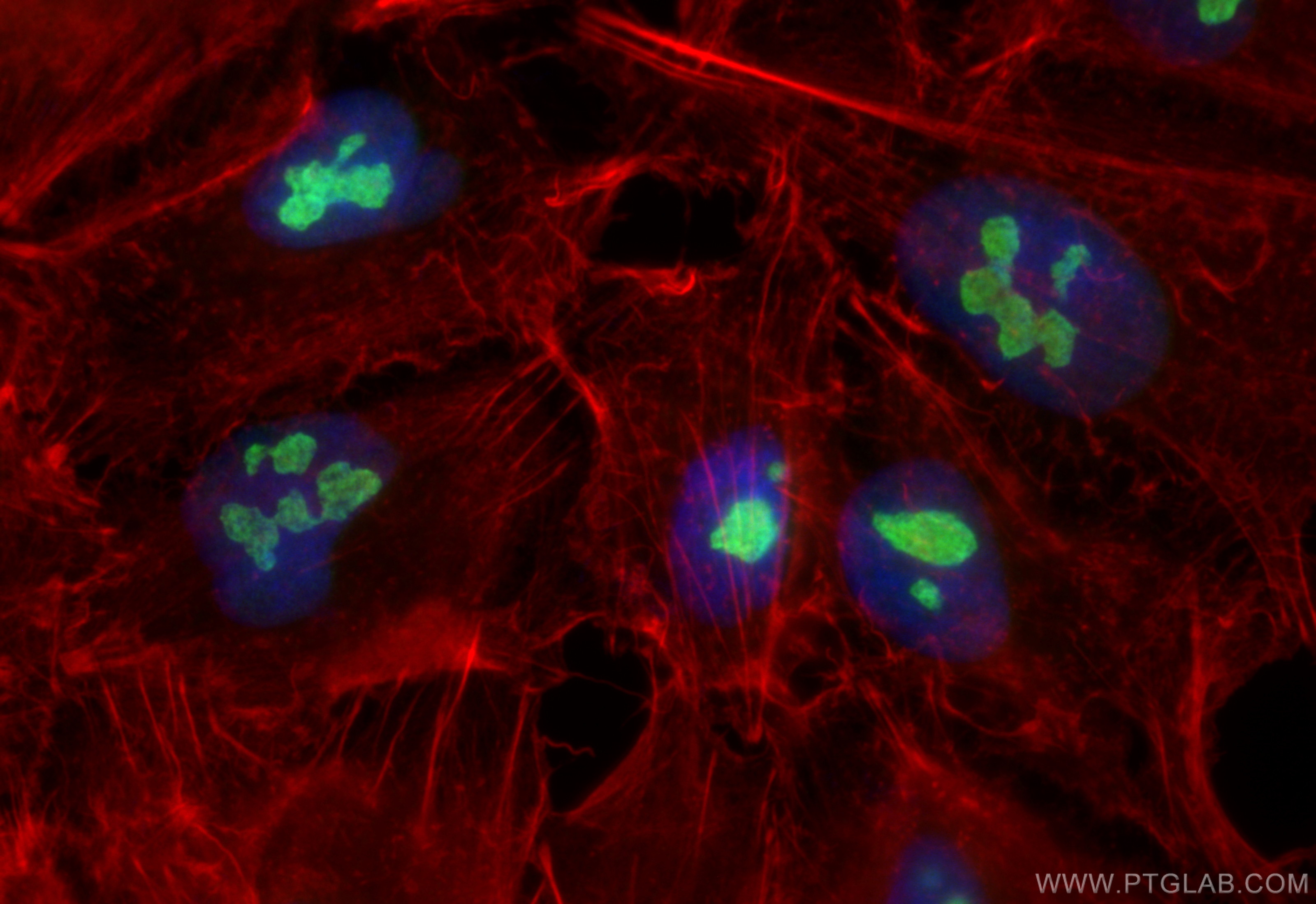 IF Staining of A549 using 14947-1-AP