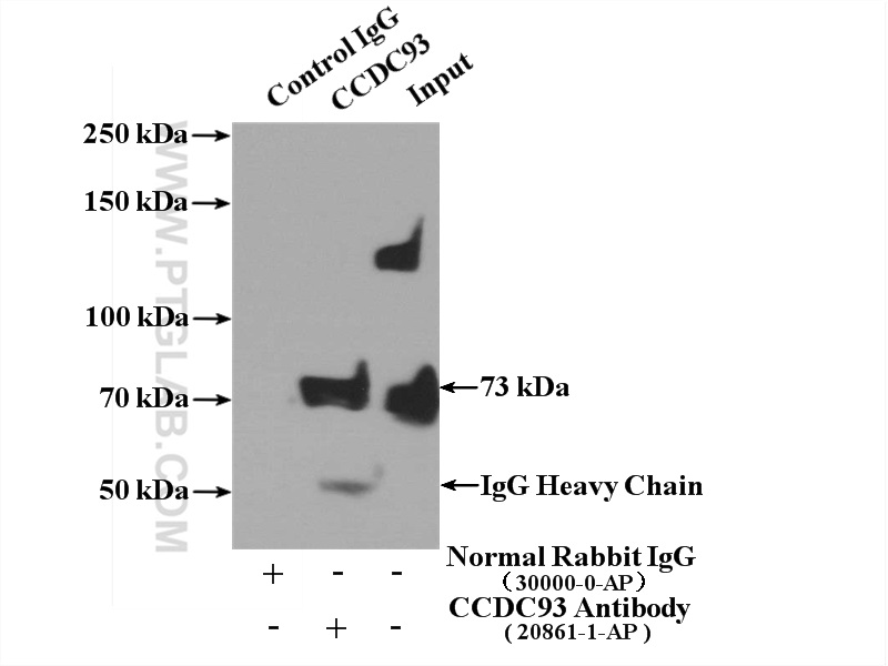 IP experiment of L02 using 20861-1-AP