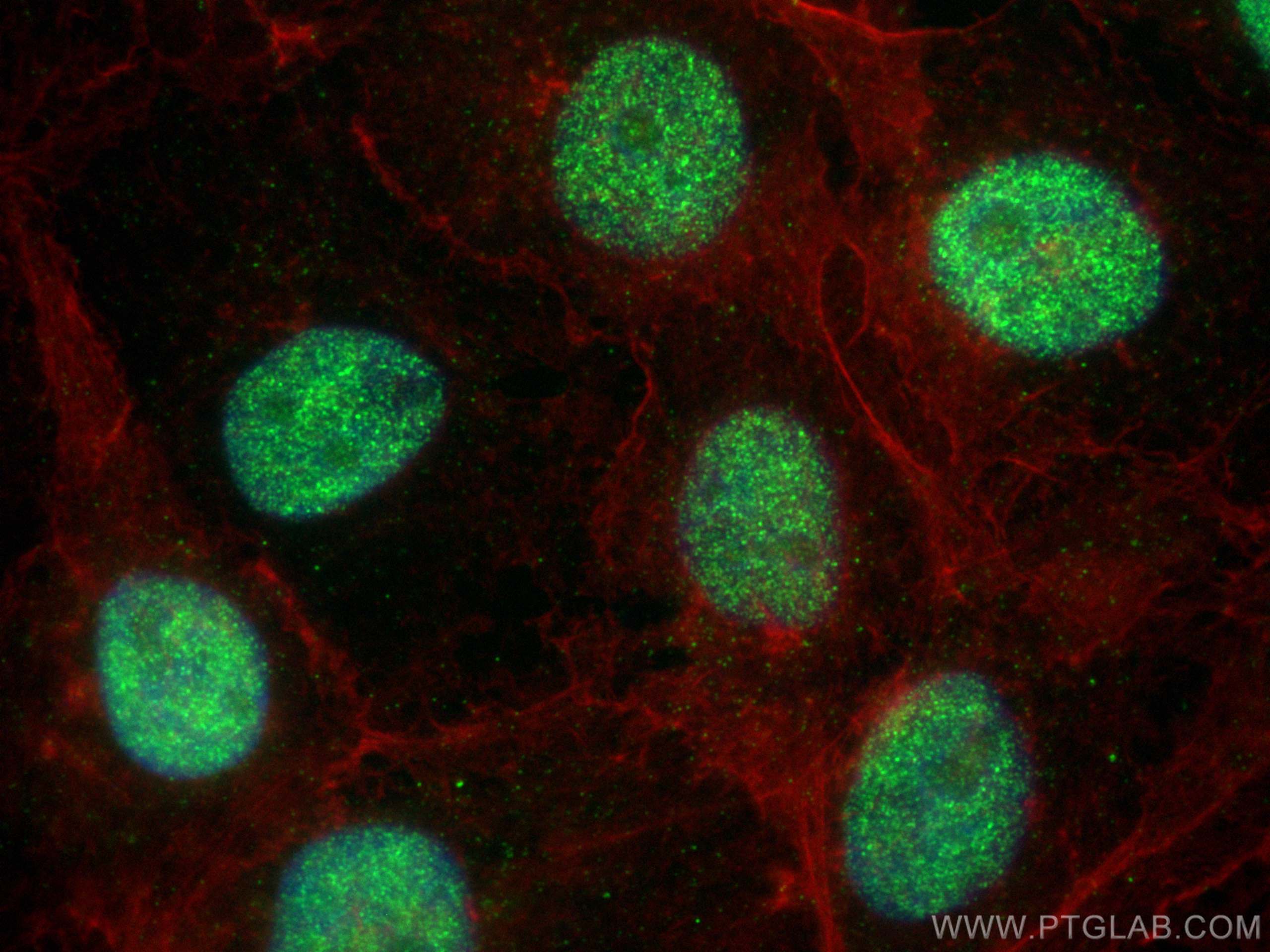 IF Staining of A431 using 68324-1-Ig (same clone as 68324-1-PBS)