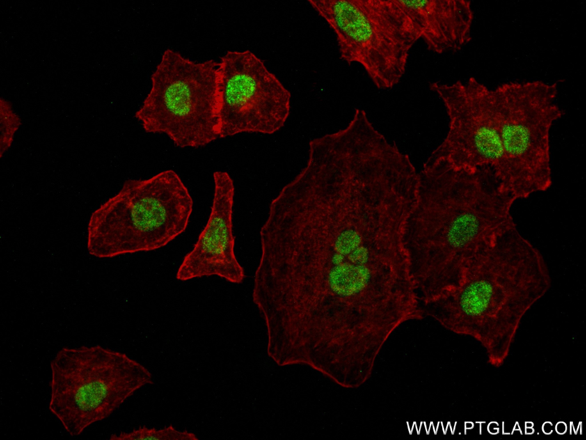 IF Staining of A549 using 83580-1-RR (same clone as 83580-1-PBS)